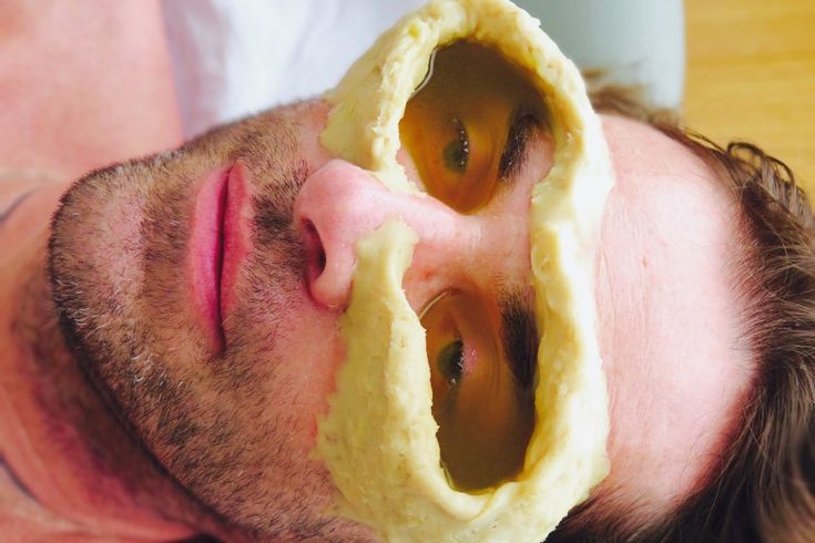 Natural Ayurvedic Solution for Dry Eyes and Vision Health